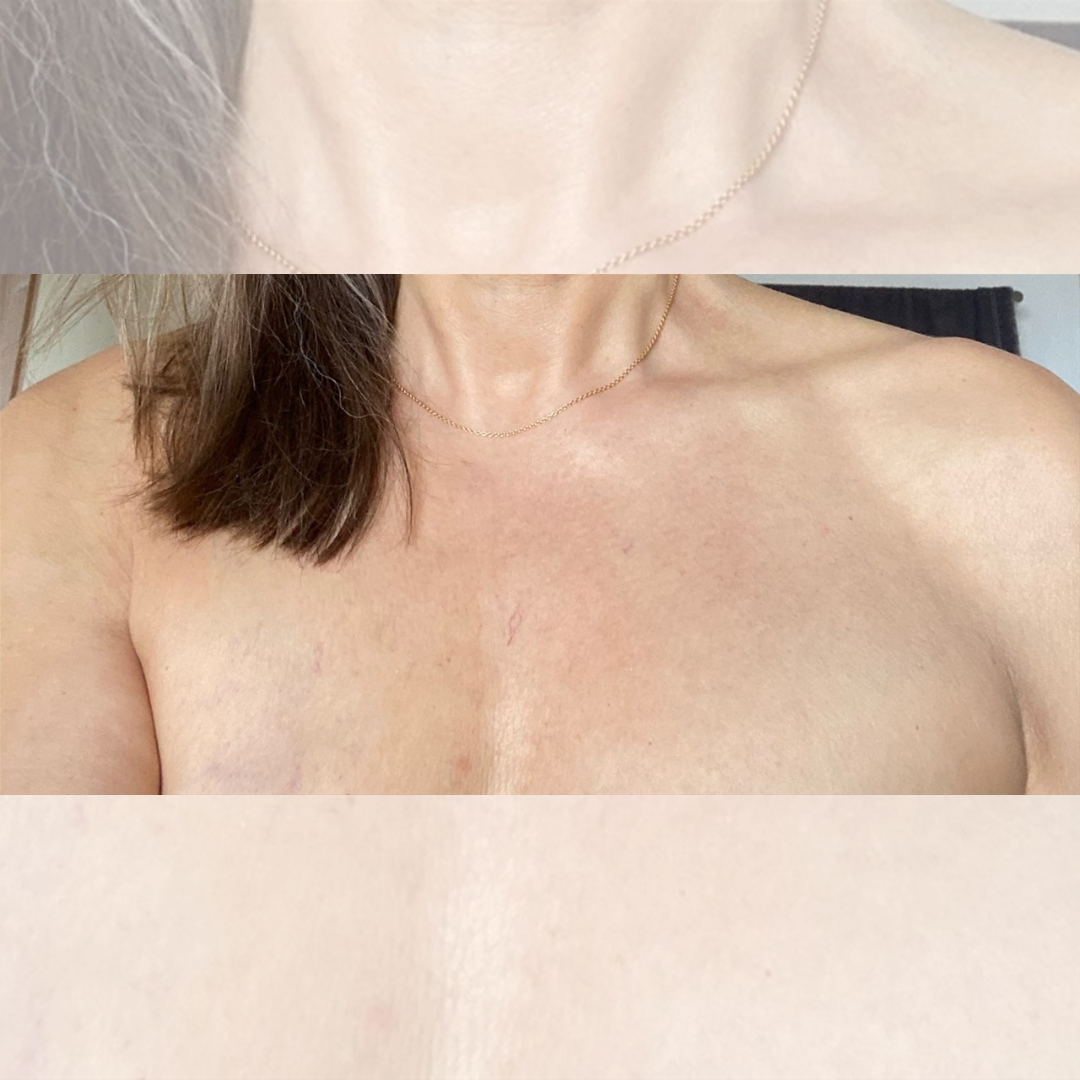 Klienthistorier helena efter 1