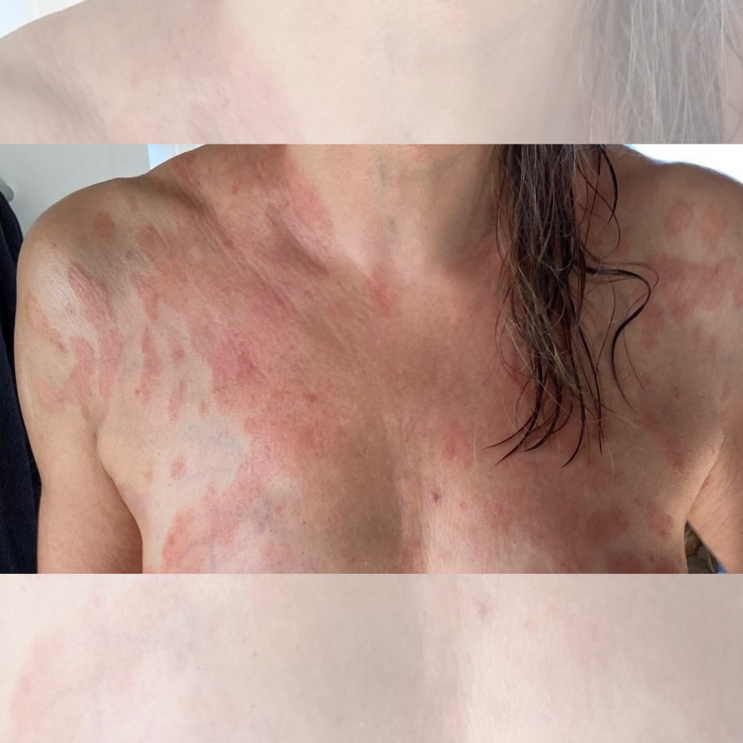 Klienthistorier helena før 1